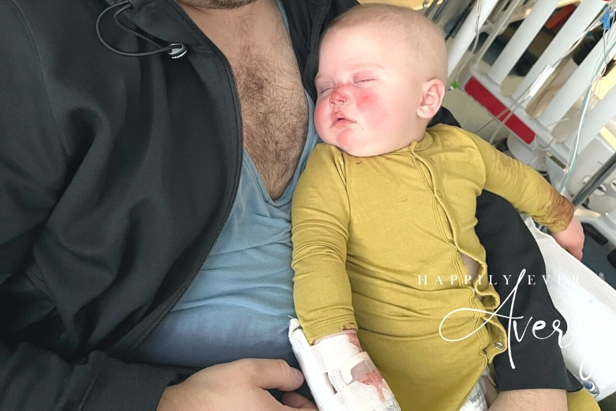 BMT DAY +10 and a half