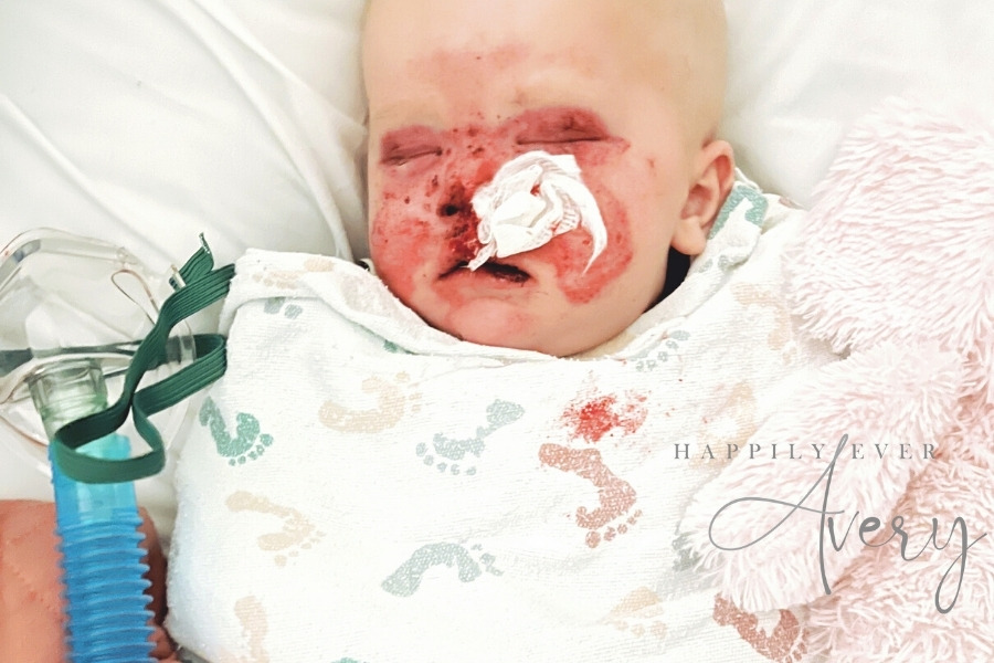 bmt day +18 urgent prayer request