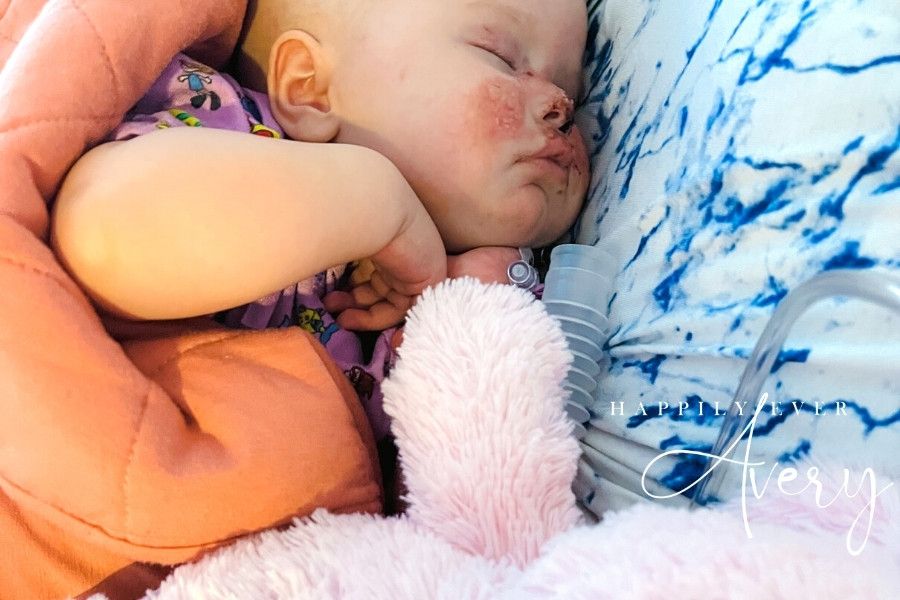 post central line replacement nap